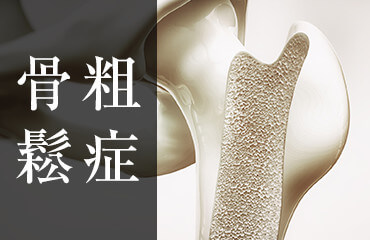 骨粗鬆症の余命はどのくらいですか?